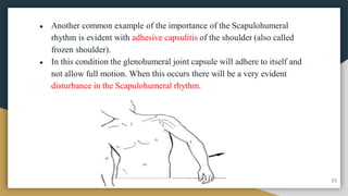 ● Another common example of the importance of the Scapulohumeral
rhythm is evident with adhesive capsulitis of the shoulder (also called
frozen shoulder).
● In this condition the glenohumeral joint capsule will adhere to itself and
not allow full motion. When this occurs there will be a very evident
disturbance in the Scapulohumeral rhythm.
15
 