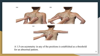 A 1.5-cm asymmetry in any of the positions is established as a threshold
for an abnormal pattern.
18
 