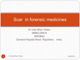 Dr Udai Bhan Yadav
MBBS,DMCH
SMO&MJ
General Hospital Alwar, Rajasthan, India,
Scar in forensic medicines
1 Dr Udai Bhan Yadav 6/28/2014
 