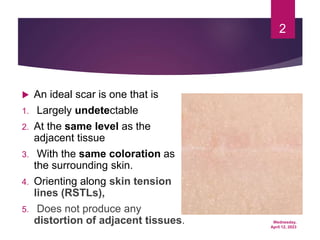 Wednesday,
April 12, 2023
2
 An ideal scar is one that is
1. Largely undetectable
2. At the same level as the
adjacent tissue
3. With the same coloration as
the surrounding skin.
4. Orienting along skin tension
lines (RSTLs),
5. Does not produce any
distortion of adjacent tissues.
 