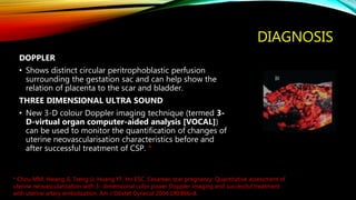 DIAGNOSIS
DOPPLER
• Shows distinct circular peritrophoblastic perfusion
surrounding the gestation sac and can help show the
relation of placenta to the scar and bladder.
THREE DIMENSIONAL ULTRA SOUND
• New 3-D colour Doppler imaging technique (termed 3-
D-virtual organ computer-aided analysis [VOCAL])
can be used to monitor the quantification of changes of
uterine neovascularisation characteristics before and
after successful treatment of CSP. *
* Chou MM, Hwang JI, Tseng JJ, Huang YF, Ho ESC. Cesarean scar pregnancy: Quantitative assessment of
uterine neovascularization with 3- dimensional color power Doppler imaging and successful treatment
with uterine artery embolization. Am J Obstet Gynecol 2004;190:866–8.
 