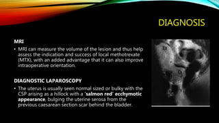 DIAGNOSIS
MRI
• MRI can measure the volume of the lesion and thus help
assess the indication and success of local methotrexate
(MTX), with an added advantage that it can also improve
intraoperative orientation.
DIAGNOSTIC LAPAROSCOPY
• The uterus is usually seen normal sized or bulky with the
CSP arising as a hillock with a ‘salmon red’ ecchymotic
appearance, bulging the uterine serosa from the
previous caesarean section scar behind the bladder.
 