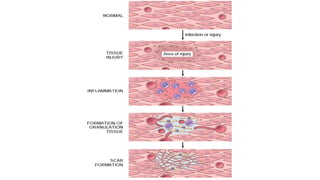 Scar Progression Presentation on Scar Formation in the process of wound healing | PPTX