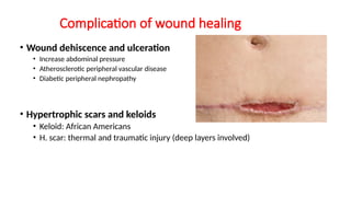 Scar Process Presentation on Scar Formation in the process of wound healing | PPTX