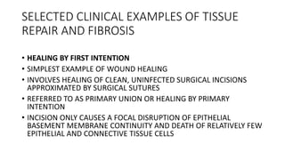 SELECTED CLINICAL EXAMPLES OF TISSUE
REPAIR AND FIBROSIS
• HEALING BY FIRST INTENTION
• SIMPLEST EXAMPLE OF WOUND HEALING
• INVOLVES HEALING OF CLEAN, UNINFECTED SURGICAL INCISIONS
APPROXIMATED BY SURGICAL SUTURES
• REFERRED TO AS PRIMARY UNION OR HEALING BY PRIMARY
INTENTION
• INCISION ONLY CAUSES A FOCAL DISRUPTION OF EPITHELIAL
BASEMENT MEMBRANE CONTINUITY AND DEATH OF RELATIVELY FEW
EPITHELIAL AND CONNECTIVE TISSUE CELLS
 
