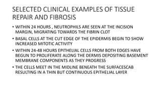 SELECTED CLINICAL EXAMPLES OF TISSUE
REPAIR AND FIBROSIS
• WITHIN 24 HOURS , NEUTROPHILS ARE SEEN AT THE INCISION
MARGIN, MIGRATING TOWARDS THE FIBRIN CLOT
• BASAL CELLS AT THE CUT EDGE OF THE EPIDERMIS BEGIN TO SHOW
INCREASED MITOTIC ACTIVITY
• WITHIN 24-48 HOURS EPITHELIAL CELLS FROM BOTH EDGES HAVE
BEGUN TO PROLIFERATE ALONG THE DERMIS DEPOSITING BASEMENT
MEMBRANE COMPONENTS AS THEY PROGRESS
• THE CELLS MEET IN THE MIDLINE BENEATH THE SURFACESCAB
RESULTING IN A THIN BUT CONTINUOUS EPITHELIAL LAYER
 
