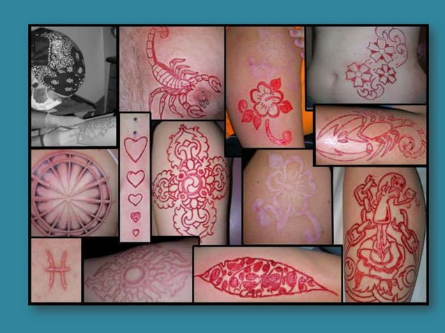 Scarification | PPT