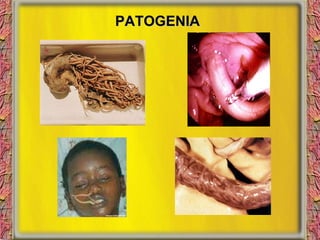 PATOGENIA 
