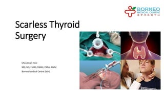 Scarless Thyroid
Surgery
Chea Chan Hooi
MD, MS, FMAS, DMAS, CMIA, AMM
Borneo Medical Centre (Miri)
 