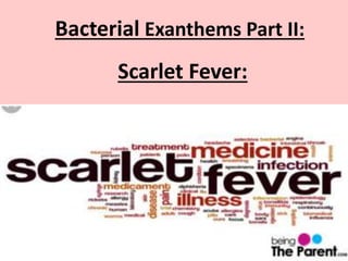Bacterial Exanthems Part II:
Scarlet Fever:
 
