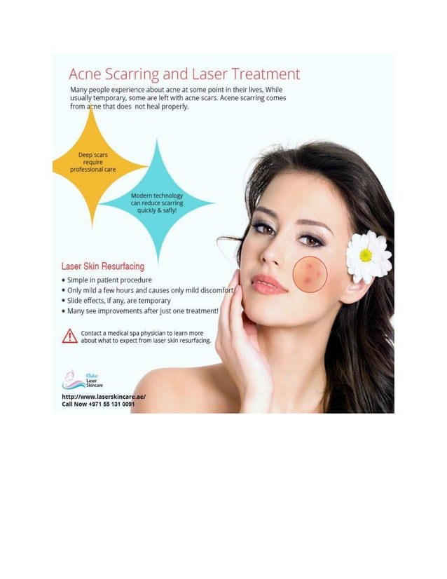 Scar removal Treatment In Dubai