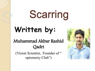 Scarring
Written by:
Muhammad Akbar Rashid
Qadri
(Vision Scientist, Founder of “
optometry Club”)
 