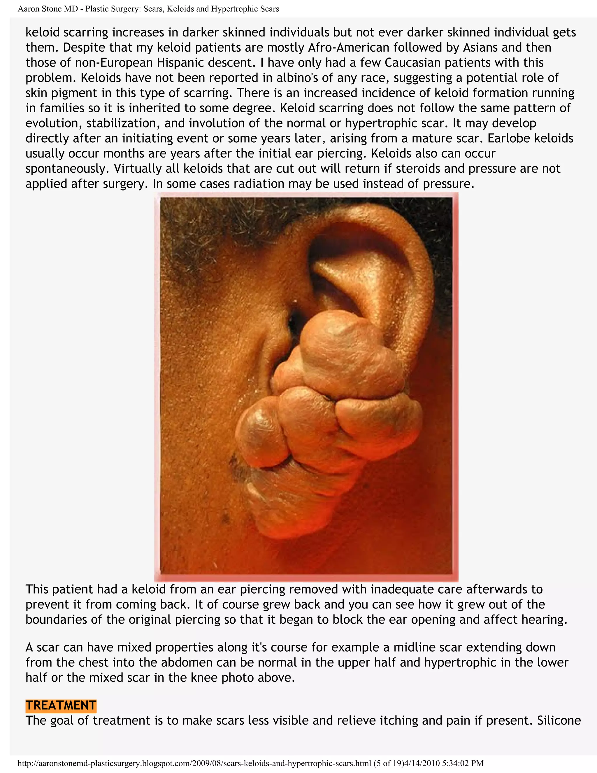 Scars keloids and hypertrophic-scars | PDF