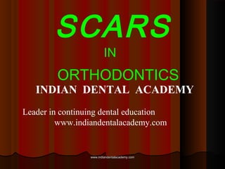 SCARS
IN

ORTHODONTICS

INDIAN DENTAL ACADEMY
Leader in continuing dental education
www.indiandentalacademy.com

www.indiandentalacademy.com

 