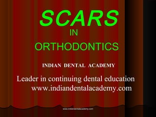 SCARSIN
ORTHODONTICS
INDIAN DENTAL ACADEMY
Leader in continuing dental education
www.indiandentalacademy.com
www.indiandentalacademy.comwww.indiandentalacademy.com
 