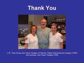 Scar Tissue Therapy Presentation Plastics
