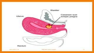 09-01-2024 17:18 DNB-OBG District Hospital 14
 