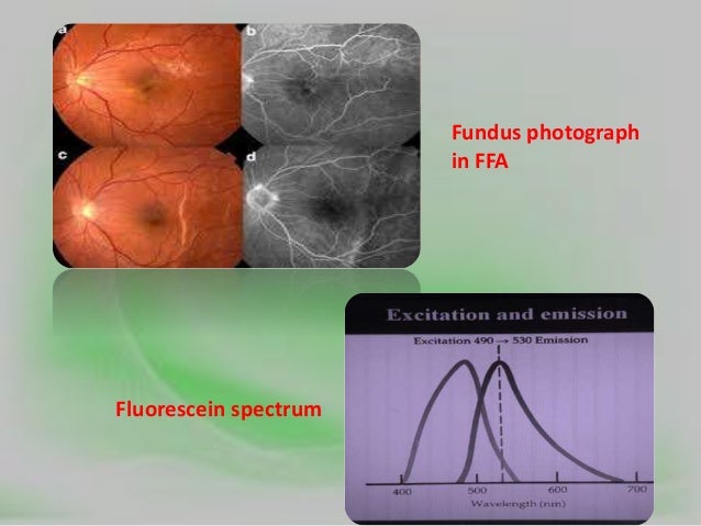 absorb o Scattering of light absorption and
