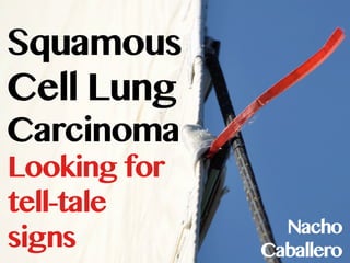 Squamous
Cell Lung
Carcinoma
Looking for
tell-tale
                Nacho
signs         Caballero
 