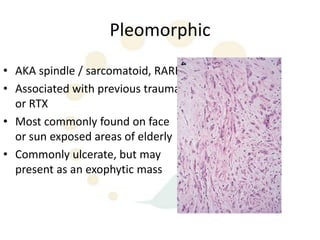 Pleomorphic
• AKA spindle / sarcomatoid, RARE
• Associated with previous trauma
  or RTX
• Most commonly found on face
  or sun exposed areas of elderly
• Commonly ulcerate, but may
  present as an exophytic mass
 