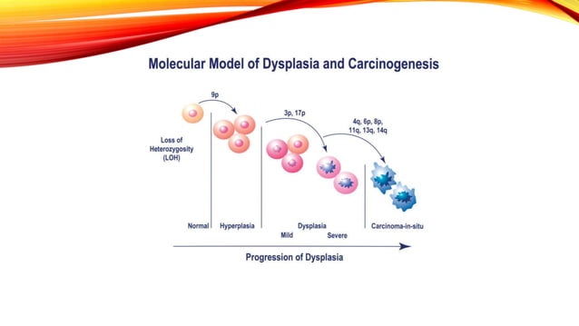 SQUAMOUS CELL CARCINOMA ORAL CANCER PPT PPT SQUAMOUS CELL CARCINOMA ORAL CANCER PPT PPT