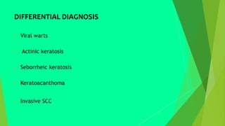 DIFFERENTIAL DIAGNOSIS
 Viral warts
 Actinic keratosis
 Seborrheic keratosis
 Keratoacanthoma
 Invasive SCC
 