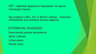  H/P – epithelial dysplasia or hyperplasia. No typical
microscopic feature.
 May progress to BCC, SCC or Bowen’s disease – induration ,
inflammation and ulceration become apparent.
DIFFERNTIAL DIAGNOSIS
 Disseminated puntate keratoderma
 Darier’s disease
 Lichen planus
 Planter warts
 