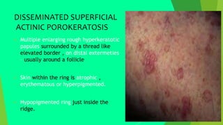 DISSEMINATED SUPERFICIAL
ACTINIC POROKERATOSIS
 Multiple enlarging rough hyperkeratotic
papules surrounded by a thread like
elevated border , on distal extermeties
– usually around a follicle
 Skin within the ring is atrophic ,
erythematous or hyperpigmented.
 Hypopigmented ring just inside the
ridge.
 