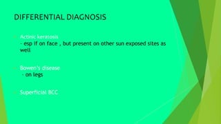 DIFFERENTIAL DIAGNOSIS
 Actinic keratosis
– esp if on face , but present on other sun exposed sites as
well
 Bowen’s disease
– on legs
 Superficial BCC
 