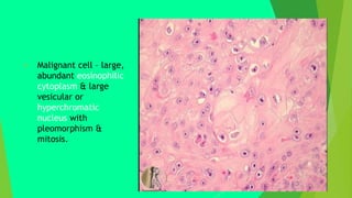  Malignant cell – large,
abundant eosinophilic
cytoplasm & large
vesicular or
hyperchromatic
nucleus with
pleomorphism &
mitosis.
 