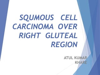 SQUMOUS CELL
CARCINOMA OVER
RIGHT GLUTEAL
REGION
ATUL KUMAR
KHARE
 