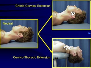 Cranio-Cervical ExtensionNeutralCervico-Thoracic Extension