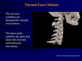 Rear End Collision Video:Occupant Motion in Slow MotionClick on image to start or pause video