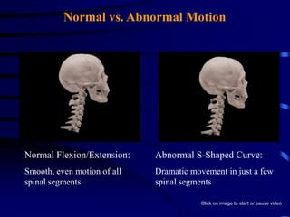Live Occupant VideoThis video clearly shows the dramatic forces that occur during a low speed collision. This was a 6 mph test crash.Click on image to start or pause videoVideo footage copyright information