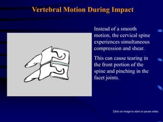 US National Safety Council / Research12 Million Car Accidents / Year1 Car Crash every 2.5 secs   >  46,000 Fatalities2.5  Million Rear End Collisions / Year1.99 Million Reported Whiplash InjuriesWAD’s all the Fuss About?