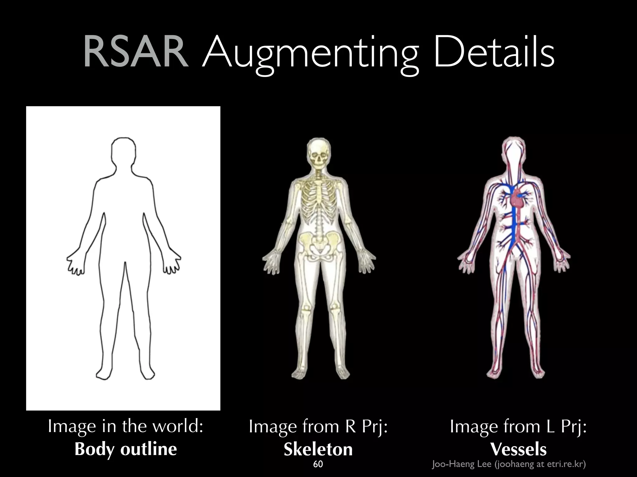 RSAR Augmenting Details

Image in the world:
Body outline

Image from R Prj:
Skeleton
60

Image from L Prj:
Vessels

Joo-Haeng Lee (joohaeng at etri.re.kr)

 