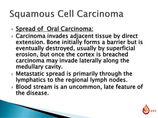  Spread of Oral Carcinoma:
 Carcinoma invades adjacent tissue by direct
extension. Bone initially forms a barrier but is
eventually destroyed, usually by superficial
erosion, but once the cortex is breached
carcinoma may invade laterally along the
medullary cavity.
 Metastatic spread is primarily through the
lymphatics to the regional lymph nodes.
 Blood stream is an uncommon, late feature of
the disease.
 
