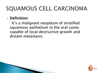  Definition:
It’s a malignant neoplasm of stratified
squamous epithelium in the oral cavity
capable of local destructive growth and
distant metastasis.
 