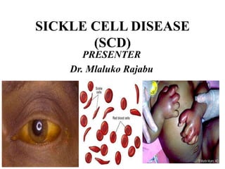 SICKLE CELL DISEASE
(SCD)
PRESENTER
Dr. Mlaluko Rajabu
 