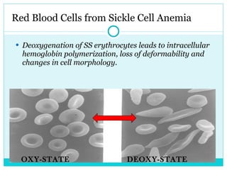Red Blood Cells from Sickle Cell Anemia Deoxygenation of SS erythrocytes leads to intracellular hemoglobin polymerization, loss of deformability and changes in cell morphology. OXY-STATE DEOXY-STATE 