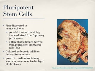 Pluripotent Stem Cells First discovered in teratocarcinoma gonadal tumors containing tissues derived from 3 primary germ layers differentiated tissues derived from pluripotent embryonic cells (EC) Cultured embryonic cell lines derived from tumors grown in medium containing serum in presence of feeder layer of fibroblasts http://www.pathconsultddx.com/pathCon/diagnosis?pii=S1559-8675(06)70552-6 