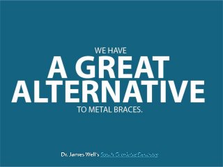 Invisalign Braces and Cost of Clear Braces in Charlotte NC