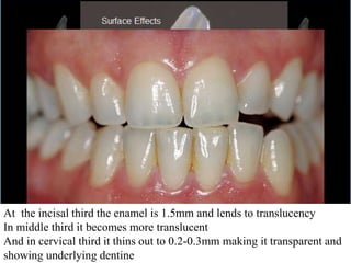 Translucent Dentin Sceince of colour and Shade Selection by Dr. Vaibhav Budakoti | PPTX