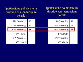 Ipertensione polmonare in cirrotico con ipertensione portale RAP (mmHg) sPAP (mmHg) mPAP (mmHg) PVR (WU) PWP (mmHg) CO (l/min) 10 66 38 RAP (mmHg) sPAP (mmHg) mPAP (mmHg) PVR (WU) PWP (mmHg) CO (l/min) 10 66 38 Ipertensione polmonare in cirrotico con ipertensione portale 