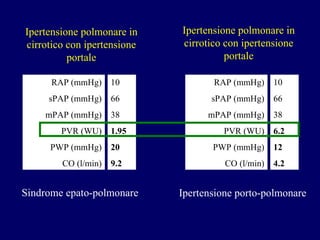 Ipertensione polmonare in cirrotico con ipertensione portale RAP (mmHg) sPAP (mmHg) mPAP (mmHg) PVR (WU) PWP (mmHg) CO (l/min) 10 66 38 1.95 20 9.2 RAP (mmHg) sPAP (mmHg) mPAP (mmHg) PVR (WU) PWP (mmHg) CO (l/min) 10 66 38 6.2 12 4.2 Ipertensione polmonare in cirrotico con ipertensione portale Ipertensione porto-polmonare Sindrome epato-polmonare 