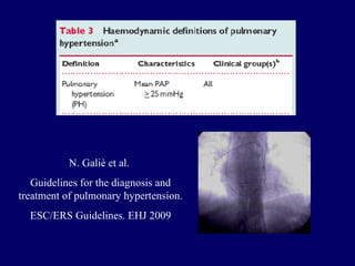 N. Galiè et al.  Guidelines for the diagnosis and treatment of pulmonary hypertension.  ESC/ERS Guidelines. EHJ 2009 