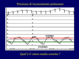 P ressione di incuneamento polmonare ESPIRO INSPIRO Qual’è il valore medio corretto ? 