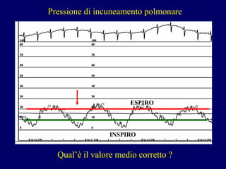 P ressione di incuneamento polmonare ESPIRO INSPIRO Qual’è il valore medio corretto ? 