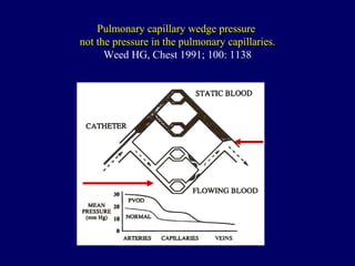 Pulmonary capillary wedge pressure  not the pressure in the pulmonary capillaries. Weed HG, Chest 1991; 100: 1138 