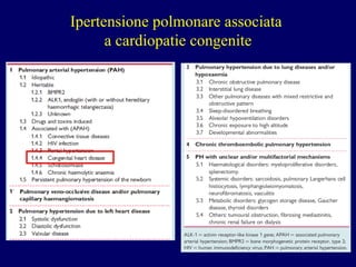 Ipertensione  p olmonare  associata  a cardiopatie congenite 